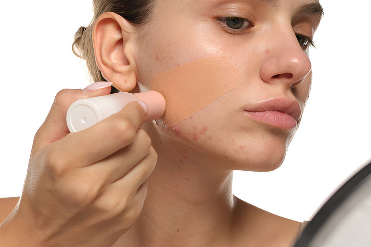 Stop Using Wrong Foundation: 10 Acne-Safe Options That Actually Work